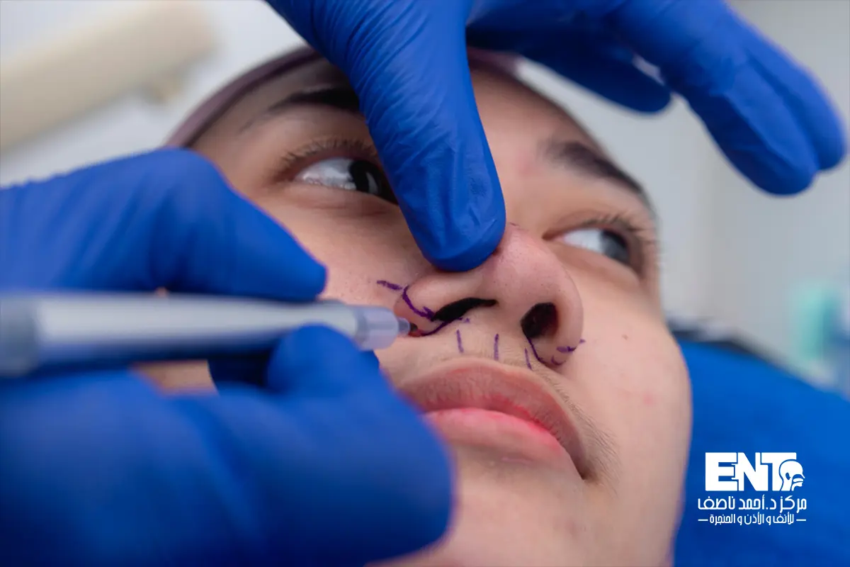 أفضل دكتور تصغير غضاريف الأنف بالكوبليشن