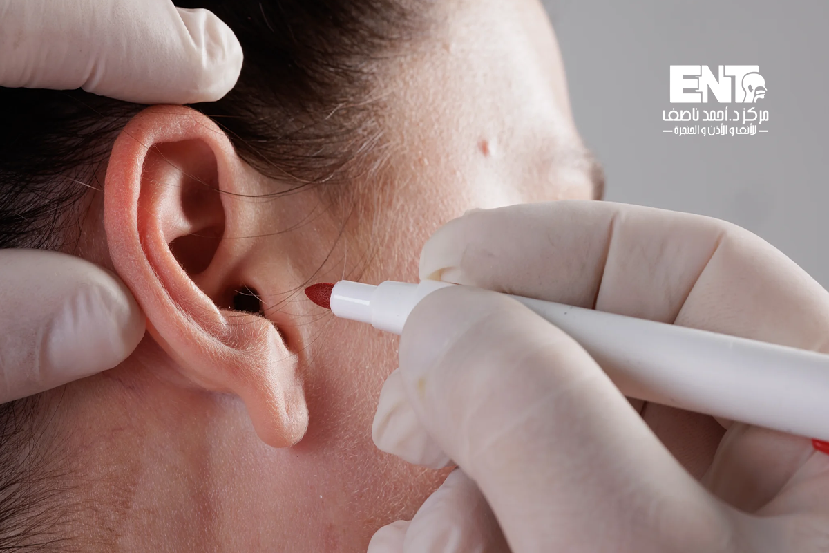 أفضل دكتور تجميل الأذن الوطواطية في الدلتا