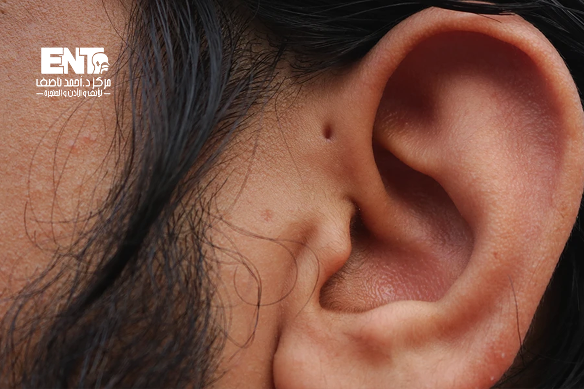 علاج ناسور الاذن مع الدكتور أحمد ناصف
